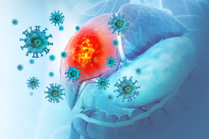 Hepatocellular carcinoma in Europe: a shifting epidemiological landscape