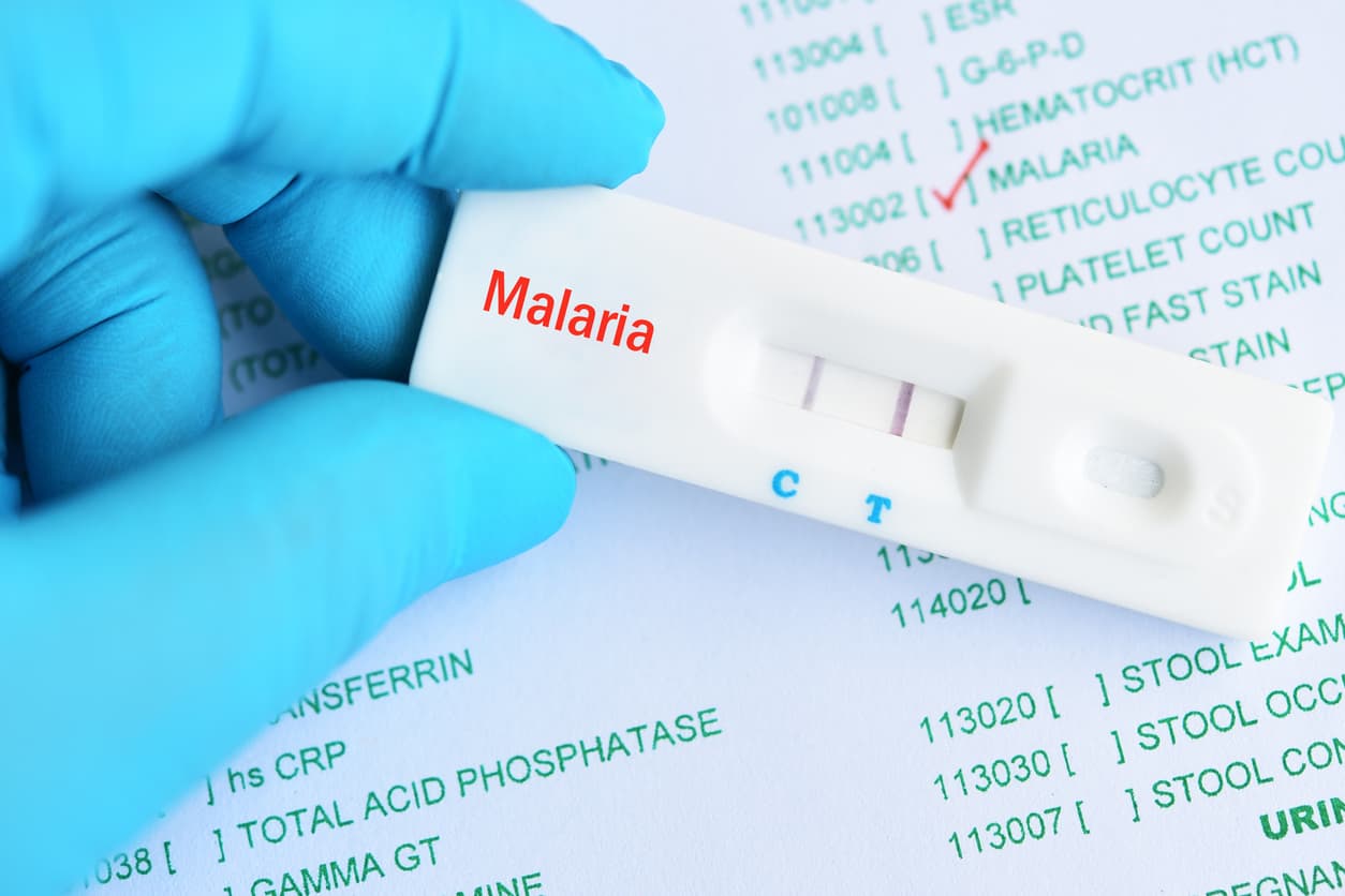 Chemokine MCP-1/CCL-2: A Promising Biomarker to Differentiate Severe and Non-Severe Malaria?