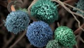 COVID-19 en réanimation : un risque accru d’aspergillose invasive