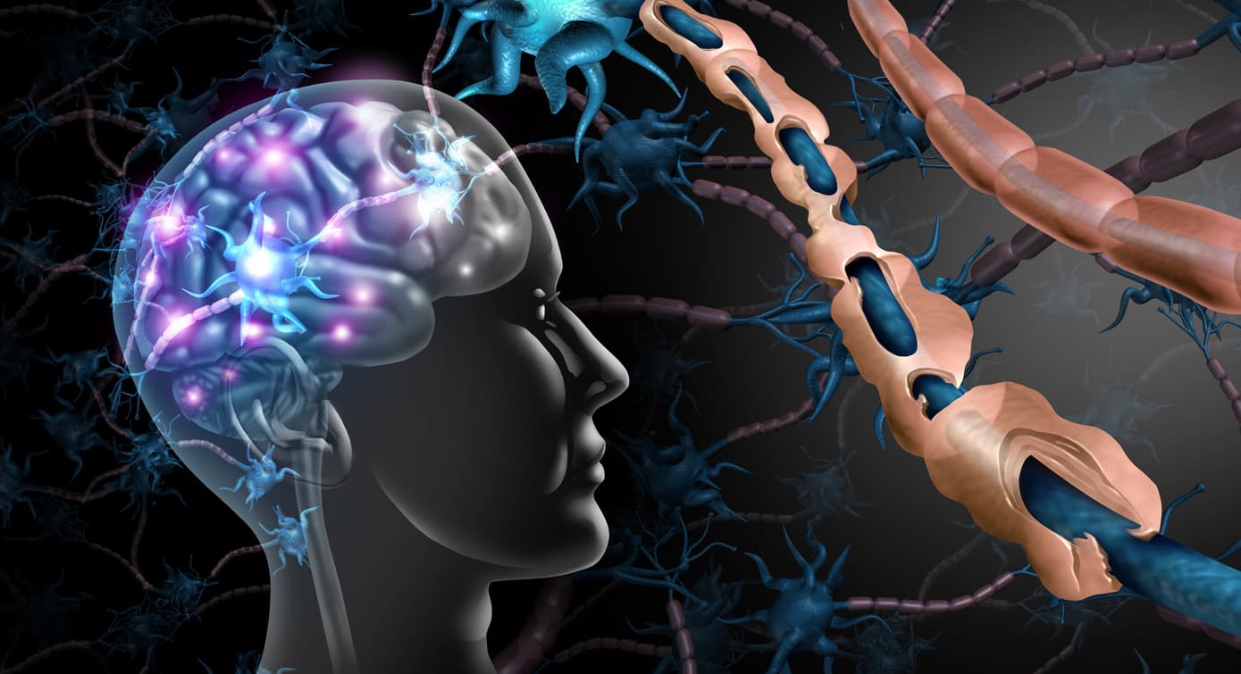 Ibudilast in multiple sclerosis