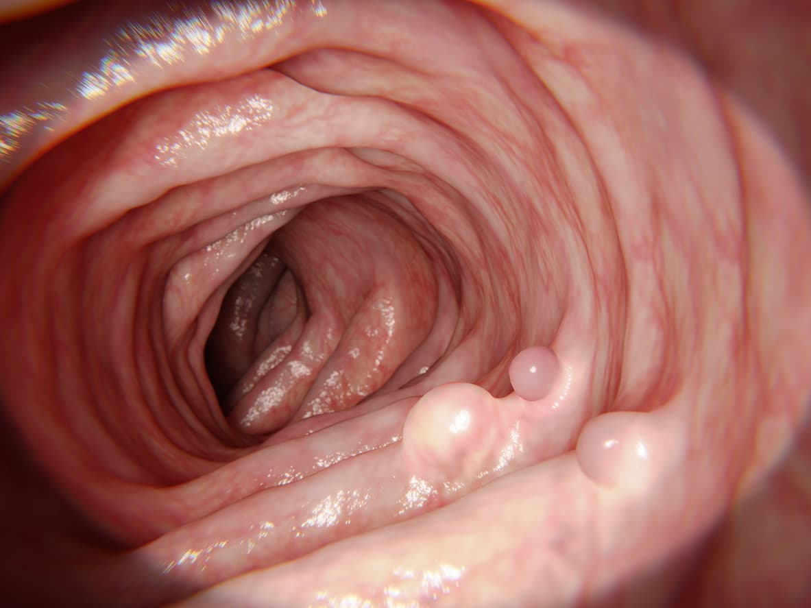 New data on the three-dimensional anatomy of the enteric nervous system