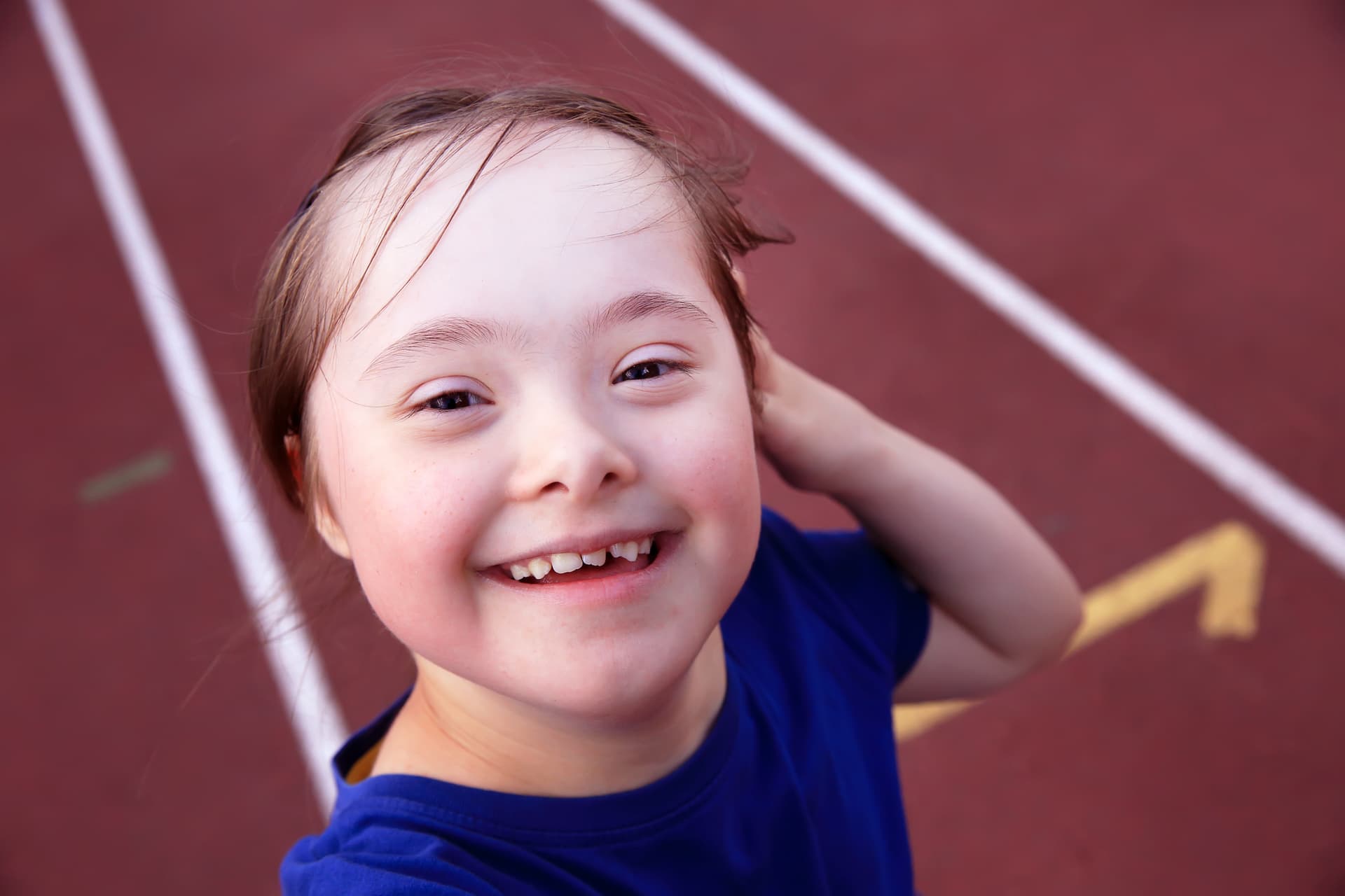 Down Syndrome and Postoperative Management: Toward Optimized Approaches in Analgesia and Sedation