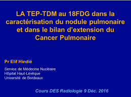 Pr E Hindie · Applications cliniques 1 - Extension tumorale initiale et planification en radiothérapie