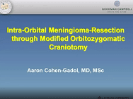 Aaron Cohen-Gadol · Intra-Orbital Meningioma-Resection through Modified Orbitozygomatic Craniotomy