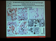 Eduardo Gotuzzo, Rogelio Hdz Pando · Session 2 - TB HIV 2019 Eduardo Gotuzzo y Rogelio Hdz Pando