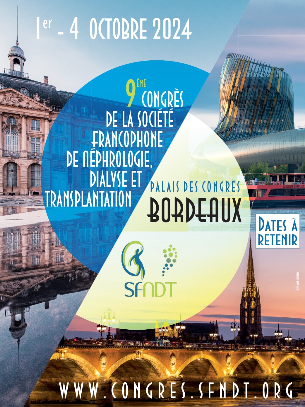9ème Congrès de la Société Francophone de Néphrologie, Dialyse et Transplantation - SFNDT 2024