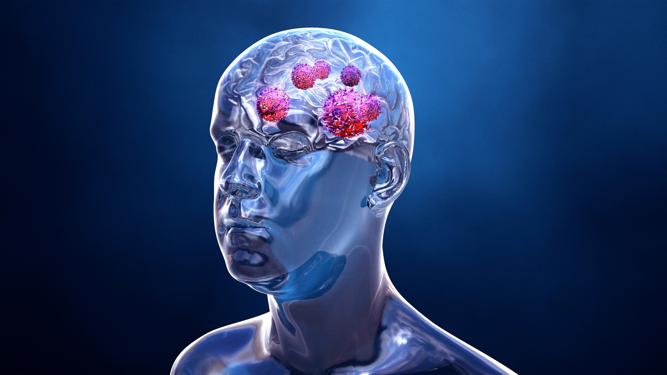 Brain under pressure: the ultimate frontier? Brain under pressure: the ultimate frontier?