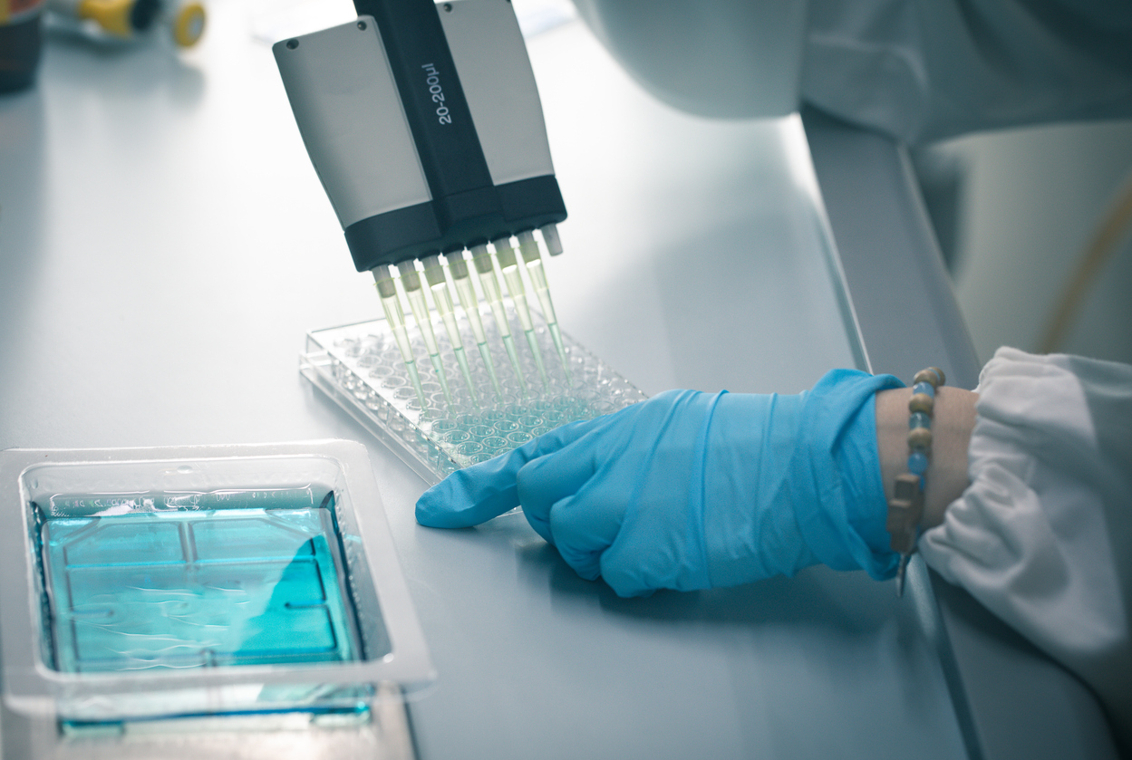 Développement d’un test en microplaques pour déterminer la méthylation de l’ARN