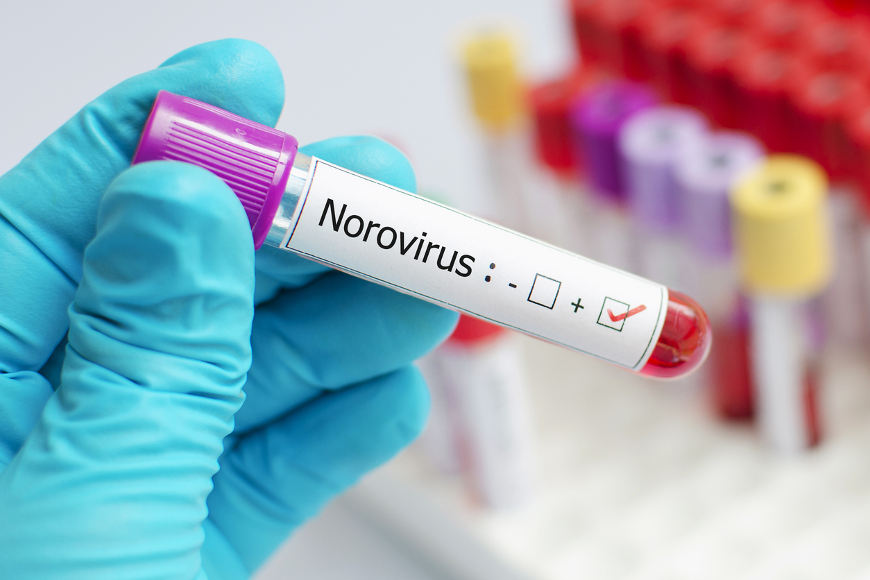 Gastro-entérite à norovirus : un tournant avec le variant GII.4 Sydney