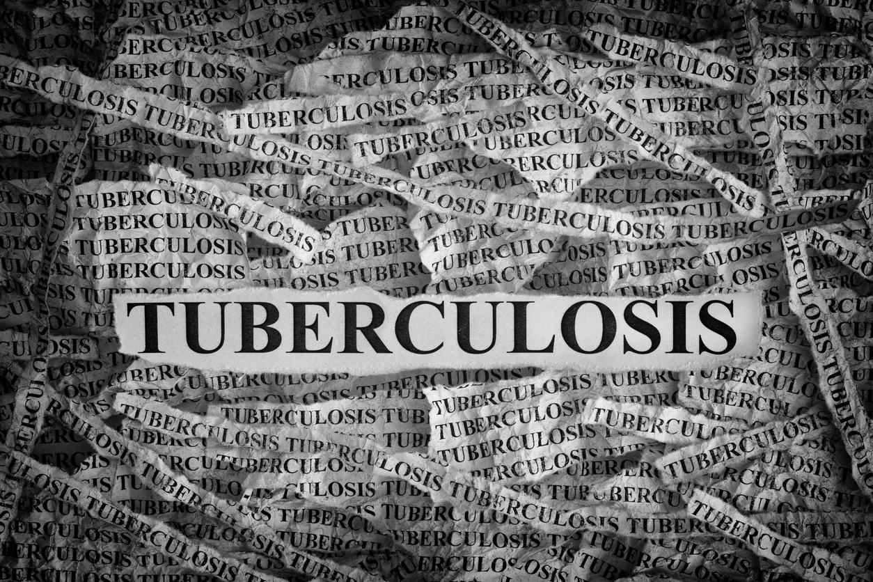 MDR-TB: 9 months to change everything?