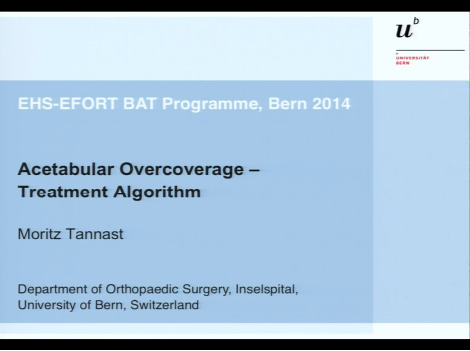 Acetabular overcoverage - treatment algorithm Acetabular overcoverage - treatment algorithm
