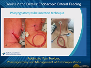 Adding to Your Toolbox: Pharyngostomy and Management of its Complications Adding to Your Toolbox: Pharyngostomy and Management of its Complications