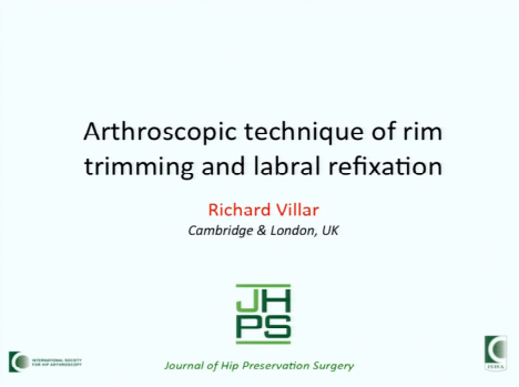 Arthroscopic technique of rim trimming and labrum refixation Arthroscopic technique of rim trimming and labrum refixation