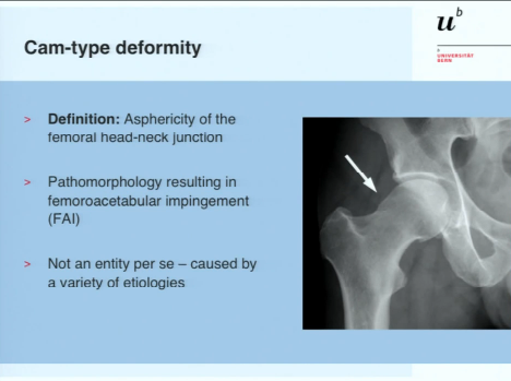 Cam-type deformities and treatment algorithm Cam-type deformities and treatment algorithm