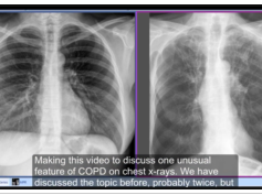 Medflixs - Chest x - ray interpretation by academyofprofessionals