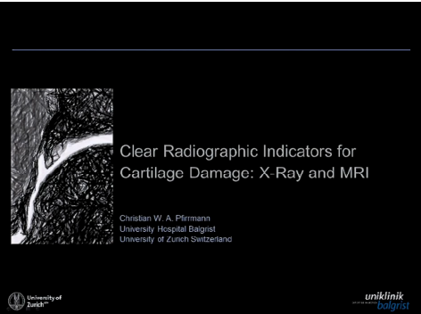 Clear radiographic indicators for cartilage damage: X-ray & MRI Clear radiographic indicators for cartilage damage: X-ray & MRI