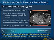Difficult PEG: Preop Evaluation and Technique in Patients Difficult PEG: Preop Evaluation and Technique in Patients