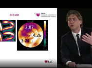 EACVI free webinar: How and why to measure LV myocardial strain