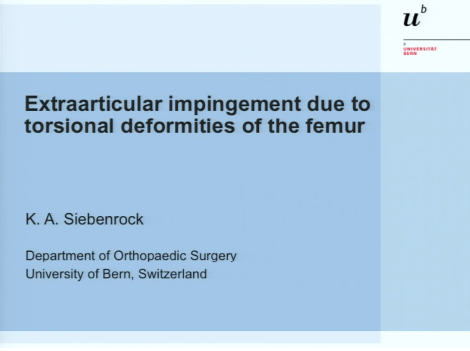 Extraarticular impingement due to femoral torsional deformities Extraarticular impingement due to femoral torsional deformities