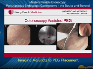 Imaging Adjuncts to PEG Placement Imaging Adjuncts to PEG Placement