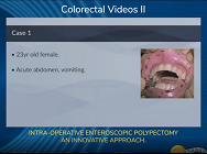 INTRA-OPERATIVE ENTEROSCOPIC POLYPECTOMY- AN INNOVATIVE APPROACH INTRA-OPERATIVE ENTEROSCOPIC POLYPECTOMY- AN INNOVATIVE APPROACH