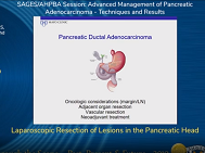 Laparoscopic Resection of Lesions in the Pancreatic Head Laparoscopic Resection of Lesions in the Pancreatic Head