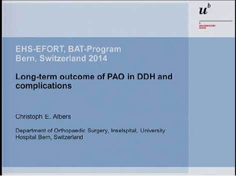 Long-term outcome of PAO in DDH and complications Long-term outcome of PAO in DDH and complications