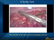 Novel surgical stapler, followup Novel surgical stapler, followup