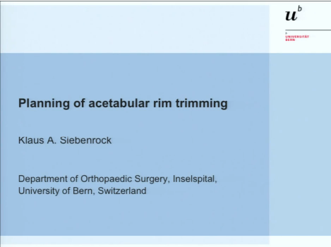 Planning of acetabular rim trimming Planning of acetabular rim trimming