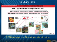 RFPi Multispectral Physiologic Visualization RFPi Multispectral Physiologic Visualization