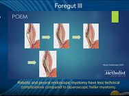 Robotic and peroral endoscopic myotomy have less technical complications Robotic and peroral endoscopic myotomy have less technical complications