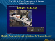 Robotic Approaches and Indications for Gastric Cancer Robotic Approaches and Indications for Gastric Cancer