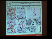Session 2 - TB HIV 2019 Eduardo Gotuzzo y Rogelio Hdz Pando Session 2 - TB HIV 2019 Eduardo Gotuzzo y Rogelio Hdz Pando