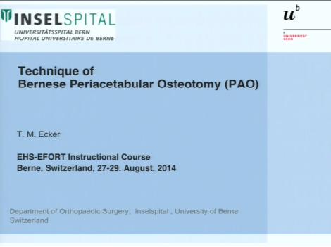 Technique of Bernese periacetabular osteotomy Technique of Bernese periacetabular osteotomy