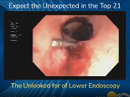 The Unlooked for of Lower Endoscopy The Unlooked for of Lower Endoscopy