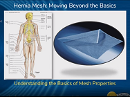 Understanding the Basics of Mesh Properties Understanding the Basics of Mesh Properties
